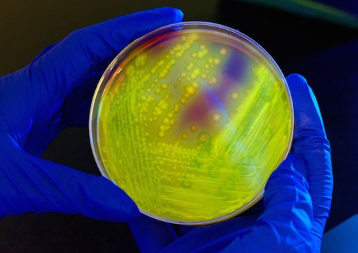 Clostridium difficile