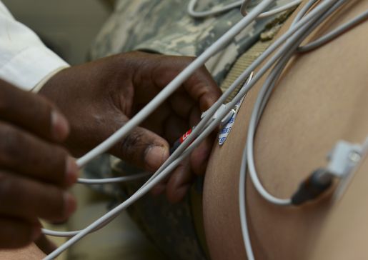 electrocardiogram